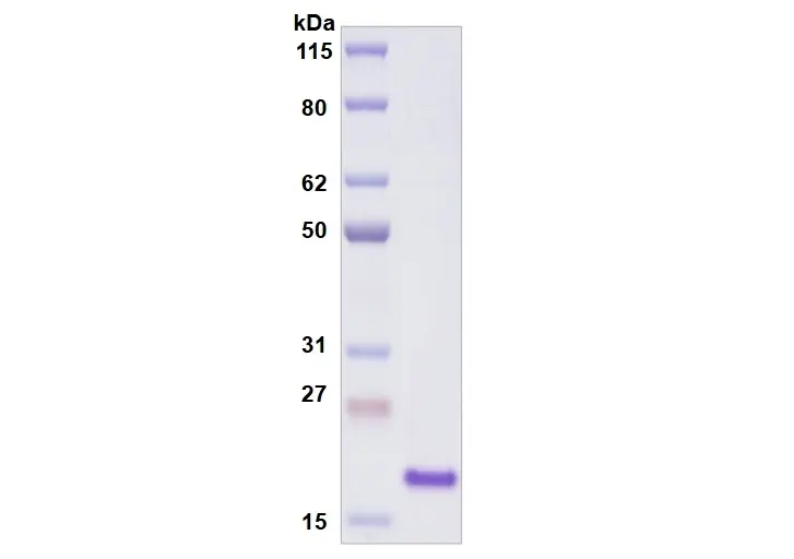 [MC12-050] Recombinant Human Siglec-9, His Tag -50 ug